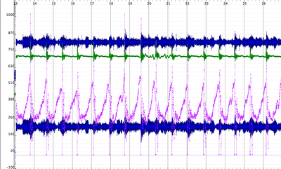 Synchronized streams in Sonic Visualizer. Here you can see two channel audio synchronized with accelerometer data (top, green) and balanceboard data (bottom, purple).